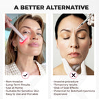 Venavu Red Light Therapy Facial Fairy Wand