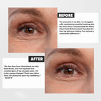 Venavu 3-in-1 LED Therapy Face Sculptor Handset