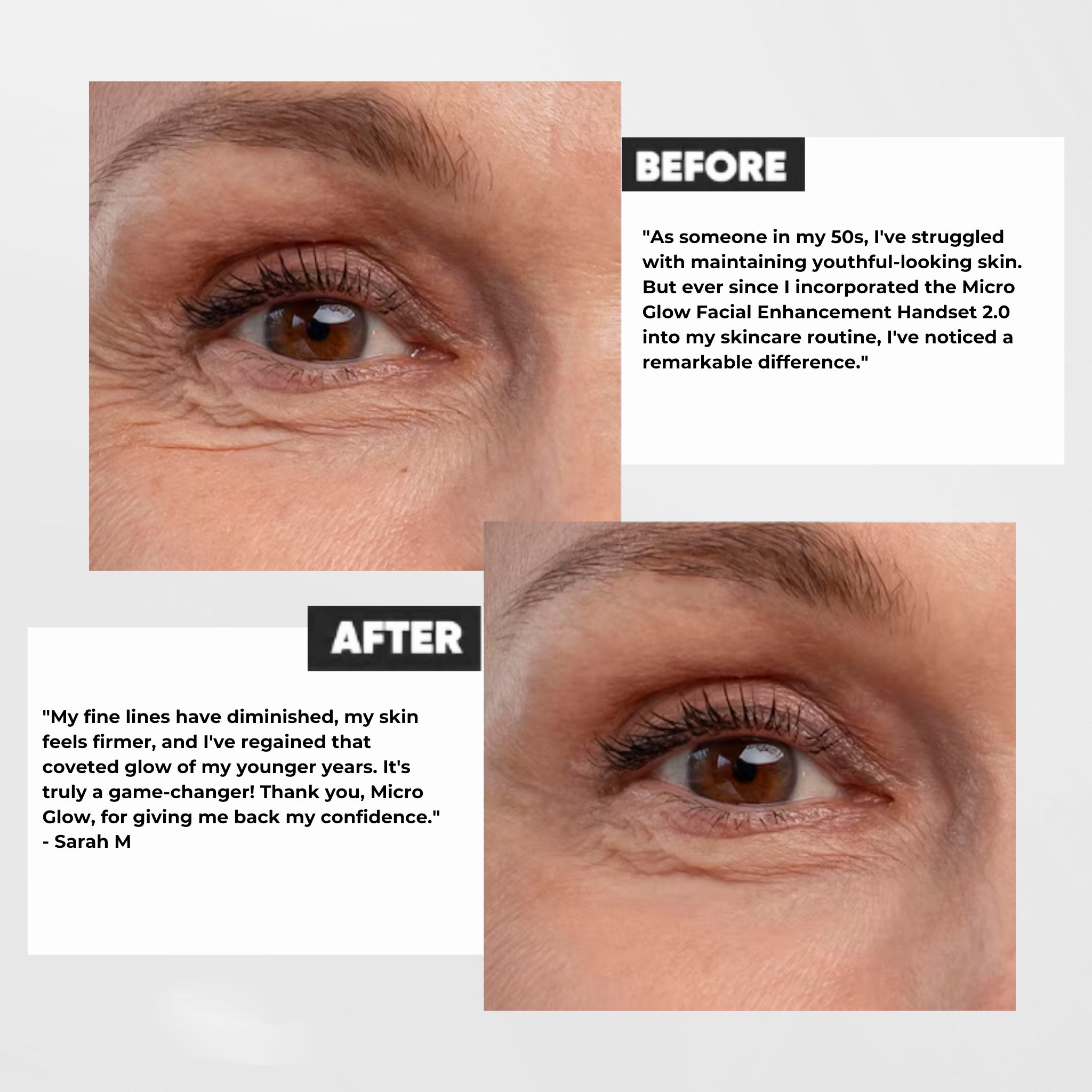 Venavu 3-in-1 LED Therapy Face Sculptor Handset