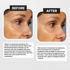 Venavu 3-in-1 LED Therapy Face Sculptor Handset