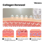 Venavu Micro Infusion System