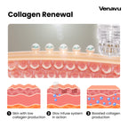 Venavu Micro Infusion System