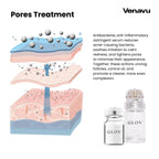 Venavu Micro Infusion System